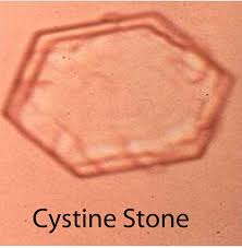 سنگ سیستئینی